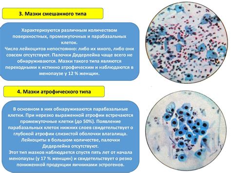 Цервикальный канал много лейкоцитов