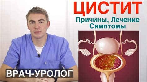 Цистит: основные причины частого желания мочиться и факторы риска