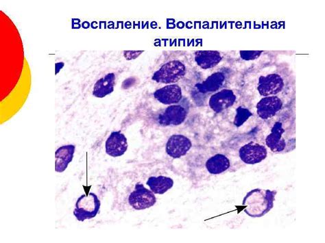 Цитология клетки с дегенеративными изменениями: основные понятия