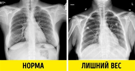 Черная кость: что это значит?