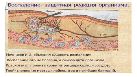 Чихание как защитная реакция организма