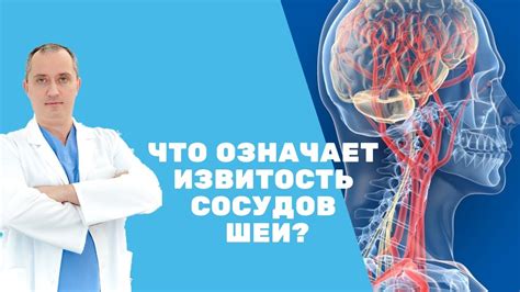 Чрезмерная извитость сосудов пуповины: причины и возможные проблемы