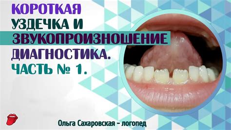 Что влияет на опухание языка?