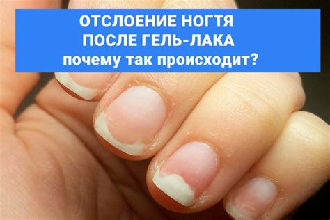 Что делать, если уже началось отслоение лака?