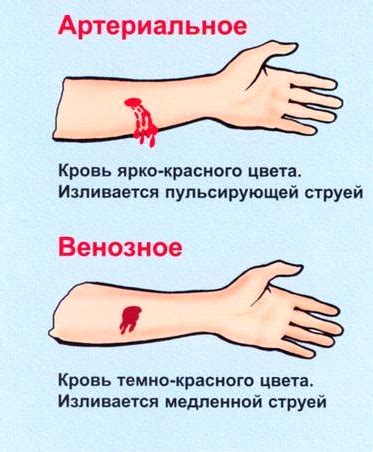 Что делать при замедленном кровотечении и как избежать осложнений?