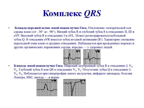 Что значит левой ориентации