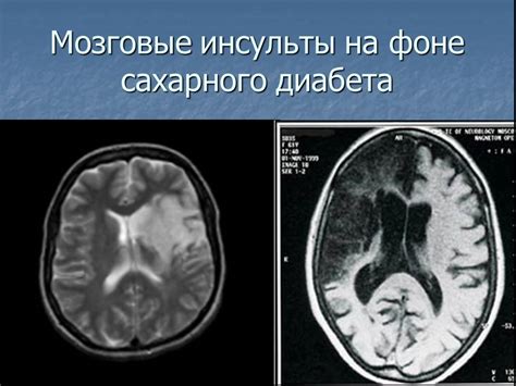 Что может быть причиной энцефалопатии у ребенка 3 месяца