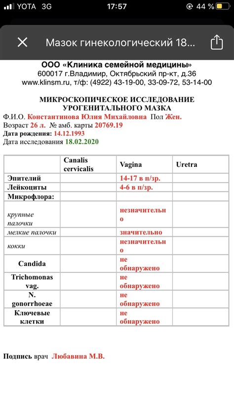 Что может влиять на результаты анализа мазка адекватного