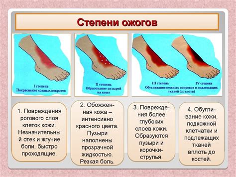 Что нельзя делать с ожогом у ребенка