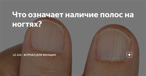 Что означает дуга на ногтях?