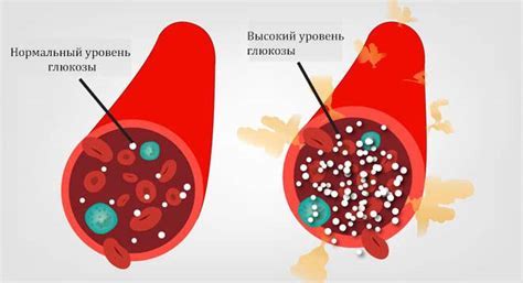 Что означает уровень глюкозы 6.5 ммоль/л и почему это важно для здоровья