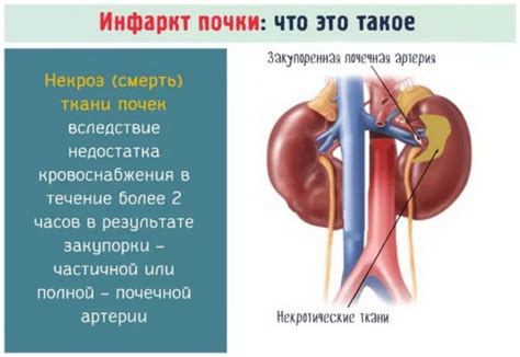 Что представляет собой стенд почки?