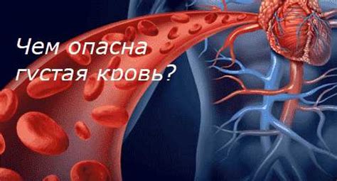 Что приводит к разжижению крови?