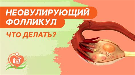 Что происходит при несостоятельности фолликула