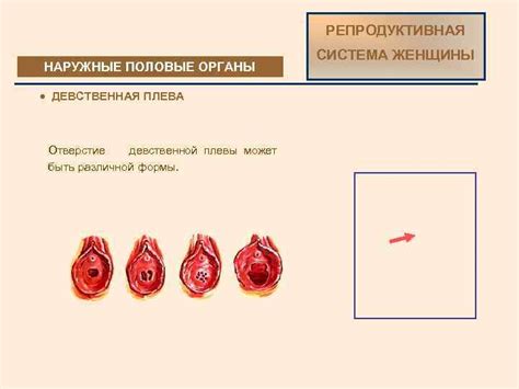 Что такое "слишком толсто"?