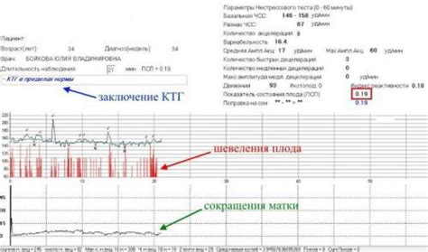 Что такое КТГ акцелерации и его норма?