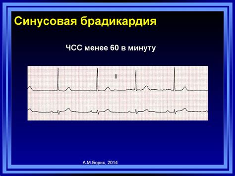 Что такое ЭКГ синусовый ритм у мужчин?
