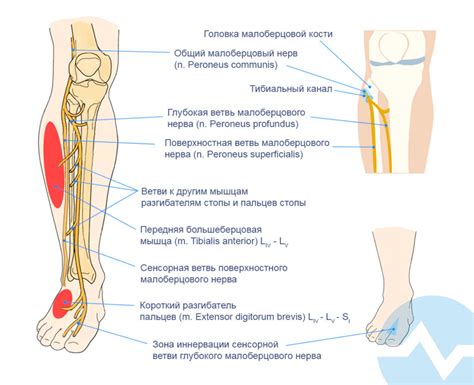 Что такое ЭНМГ нижних конечностей?