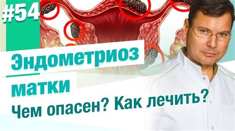 Что такое внутренний эндометриоз