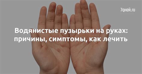 Что такое водянистые пузырьки на руках?