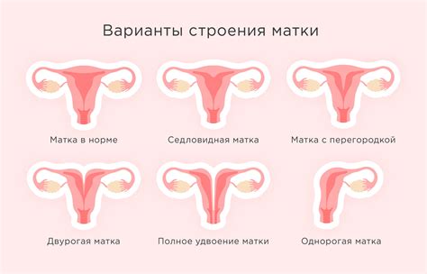 Что такое гетерогенная структура матки?