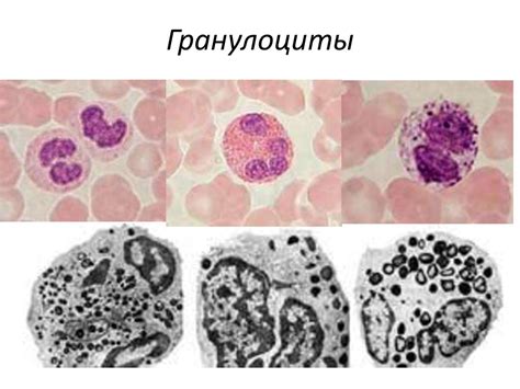 Что такое гранулоциты?