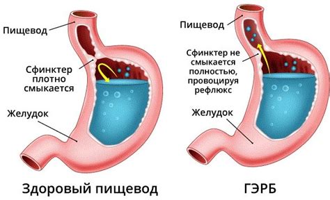 Что такое гэрб?