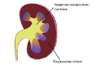 Что такое истонченная паренхима почки?