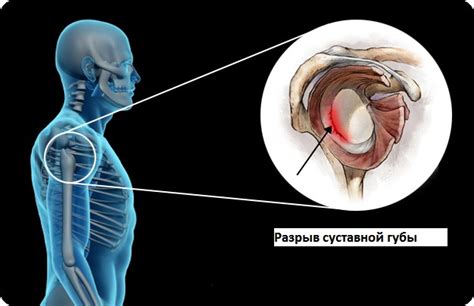 Что такое капризная губа?