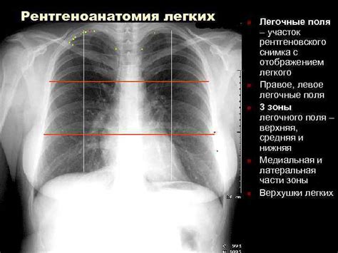 Что такое легочные поля?