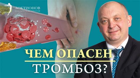 Что такое легочный тромбоз и каковы его причины?