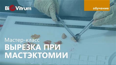 Что такое мастэктомия по Маддену?