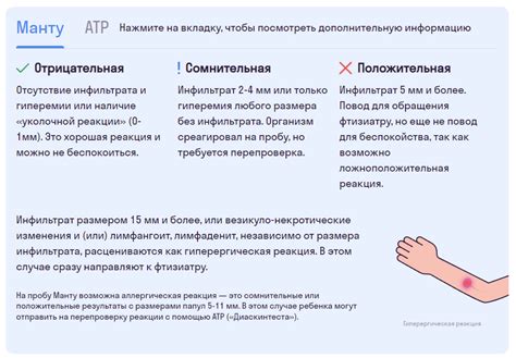 Что такое мочил манту и зачем это нужно?