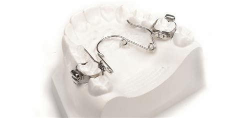 Что такое небный бюгель в ортодонтии?