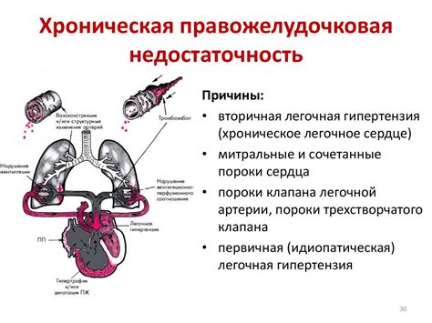 Что такое недостаточность кровообращения