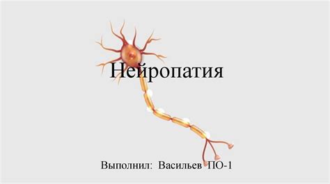 Что такое нейропатия и как она проявляется?