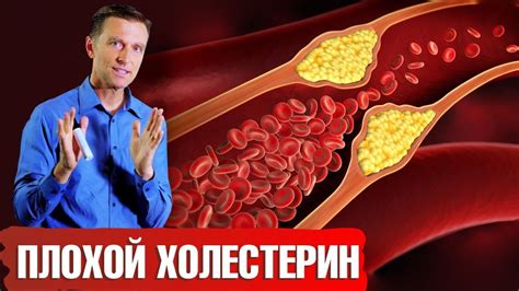 Что такое низкий уровень липопротеинов низкой плотности?