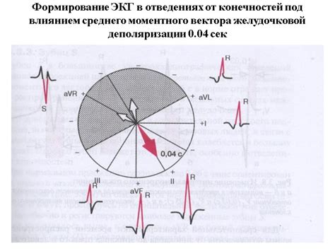 Что такое низкоамплитудная ЭКГ от конечностей?