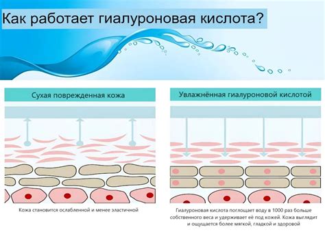 Что такое перекрестно связанная гиалуроновая кислота?