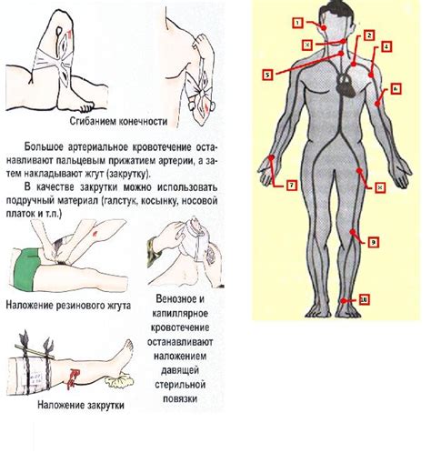 Что такое плевроапикальные наложения справа?