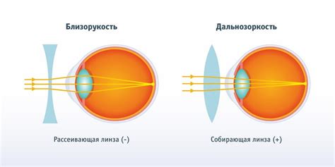 Что такое плюс-минус в офтальмологии и его влияние на зрение?