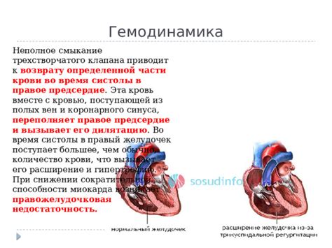 Что такое повышение сократительной способности миокарда и как оно влияет на организм?