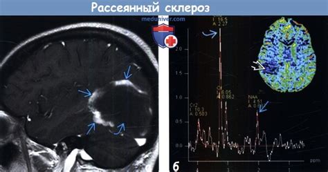 Что такое положительная динамика при обследовании МРТ