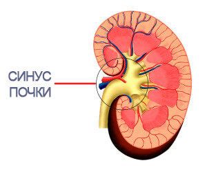 Что такое почечный синус?