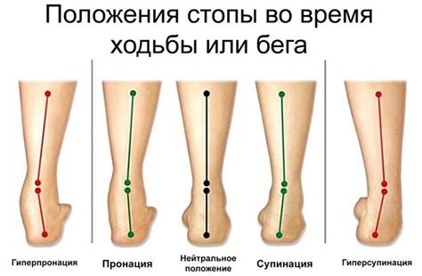 Что такое пронация?