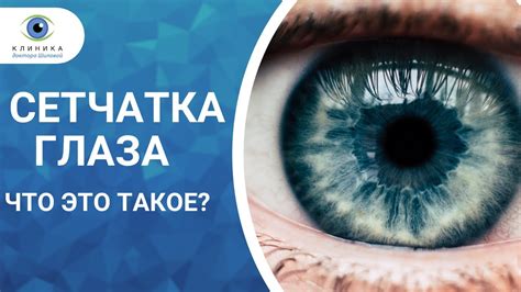 Что такое разряженная сетчатка и как она влияет на зрение?