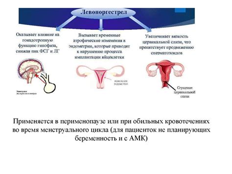 Что такое ретроцервикальный эндометриоз?