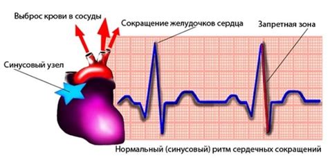 Что такое сорванный ритм сердца