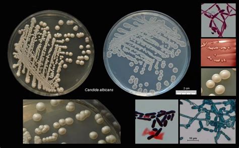 Что такое споры Candida и как их определить?