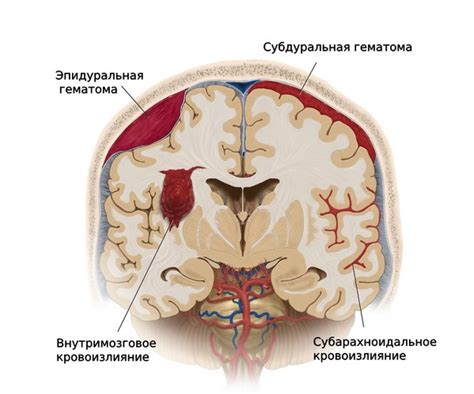 Что такое субарахноидальное конвекситальное пространство?